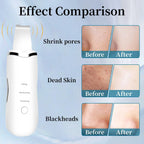 Electric facial cleanser with vibration and deep cleansing